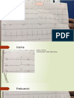 Ekg