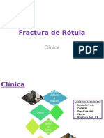 Fractura de Rótula