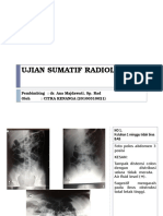 UJIAN SUMATIF RADIOdfsLOGI