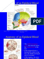 Anatomy of An Epidural Bleed: January 17, 2007 Pipeline Neuroscience: Epidural Hemorrhage
