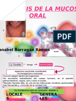 Candidiasis Bucal