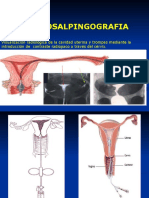 Diagnóstico Por Imagen II - Histerosalpingografía