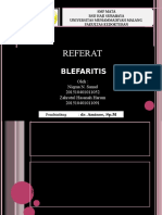 Blefaritis