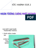  Hien Tuong Cang Mat Ngoai