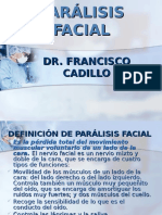 7 Paralisis Facial