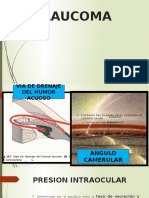 Glaucoma: clasificación, factores de riesgo y tratamiento