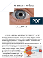 Ochiul-cataracta