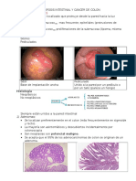 Poliposis Intestinal y Cancer de Colon