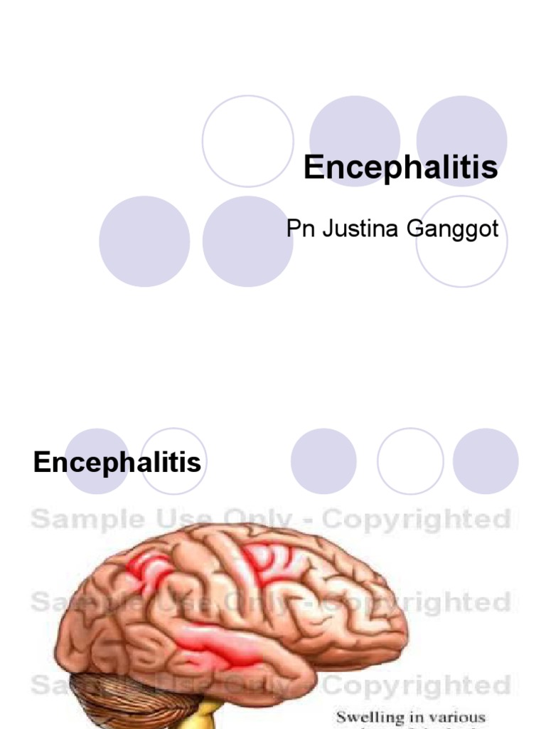 Panduan Encephalitis untuk Medis | PDF | Pengembangan Diri