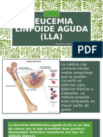 Leucemia Linfoide Aguda (LLA)