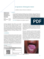 Peripheral Squamous Odontogenic Tumor: Hort Ommunication