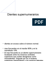 Dientes Supernumerarios