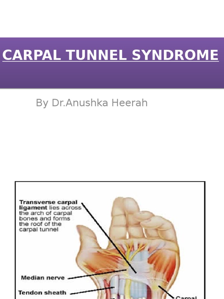 Carpal Tunnel Syndrome | PDF | Carpal Tunnel Syndrome | Hand
