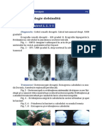 Patologie Dobandita Ureter