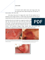 Stomatitis Aphthous Recurrent