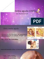 Otitis Media Aguda (OMA)