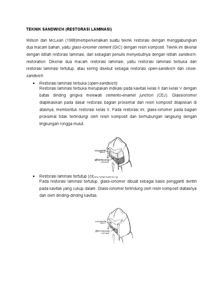 Teknik Sandwich | PDF