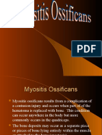 Myositis Ossificans 1 2