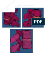 Hexamesh of L3-L4 Model by Using Ia-Femesh and Hypermesh