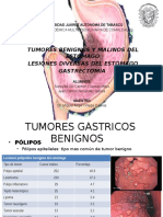 Tumores Malignos Estomago y Gastrectomia