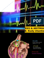 EKG & ARITMIA: Understanding Heart Rhythms Through EKG Interpretation