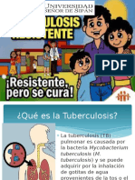 Tuberculosis