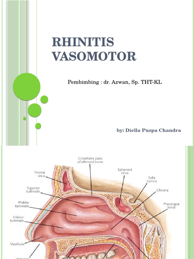 Rhinitis Vasomotor: Gejala dan Penanganan | PDF | Sains & Matematika
