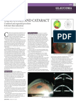 Glaucoma and Cataract