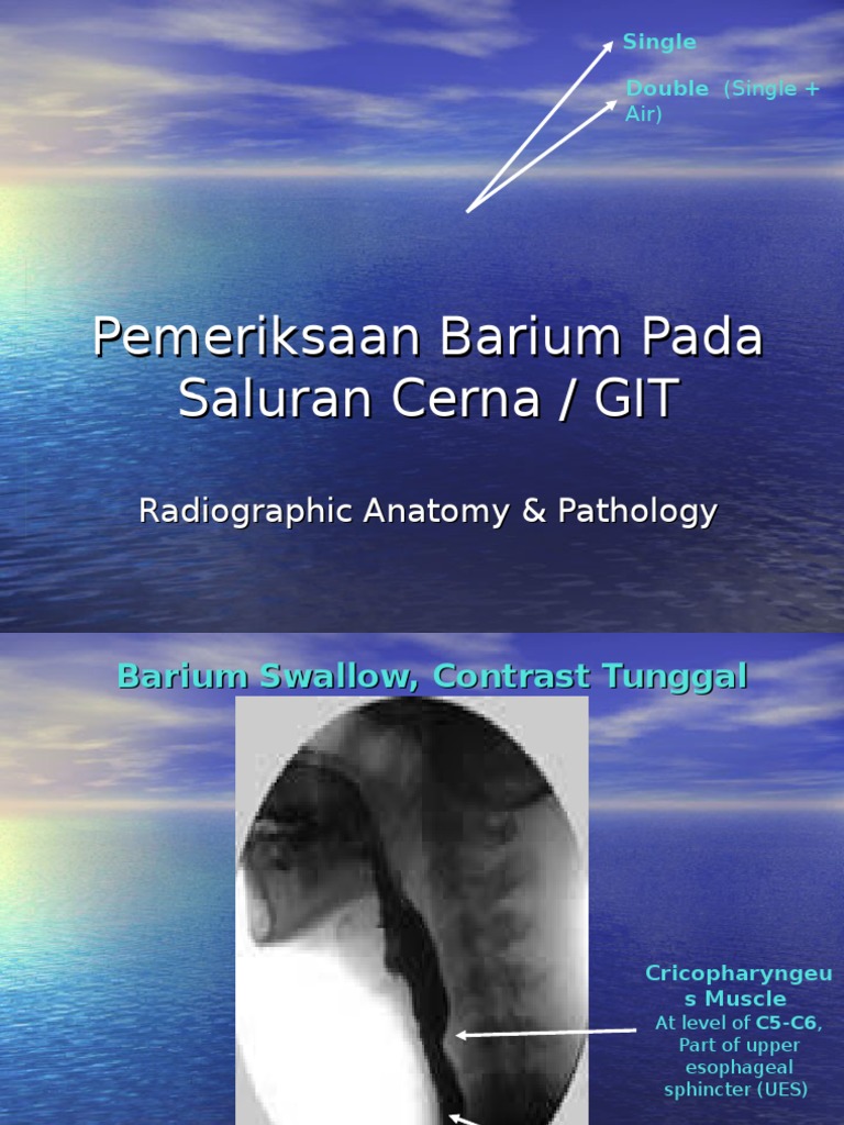 Barium Studies in Gastrointestinal Imaging | PDF | Esophagus | Large ...