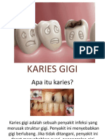 Karies Gigi PDF