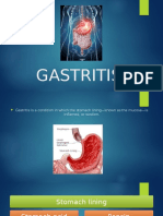 Gastritis