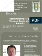 Sinusitis