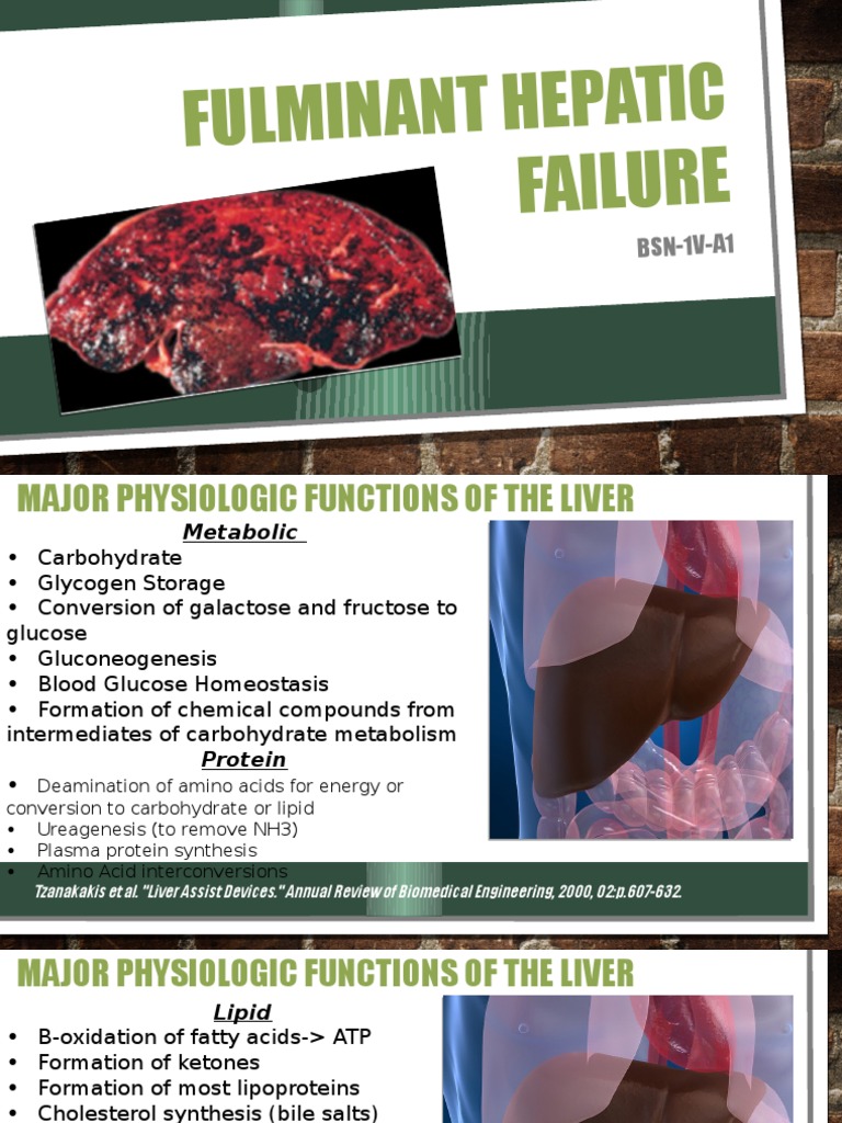 Fulminant Hepatic Failure Overview | PDF | Liver | Organ (Anatomy)