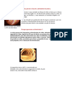 Doença Diverticular Do Cólon