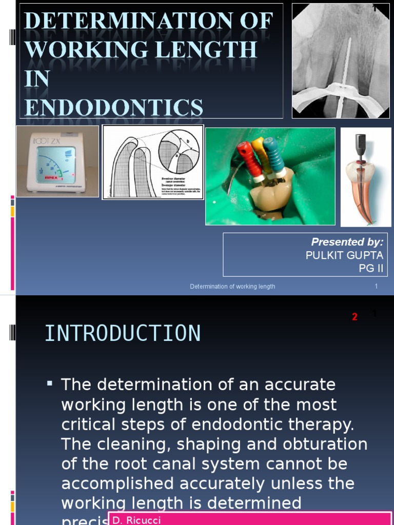 Determination of Working Length PDF Nature