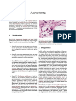 Astrocitoma.pdf