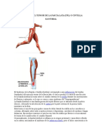 Tendinitis Del Tensor de La Fascia Lata