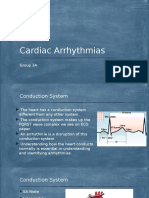 Cardiac Arrhythmias: Group 3A