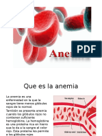 Anemia