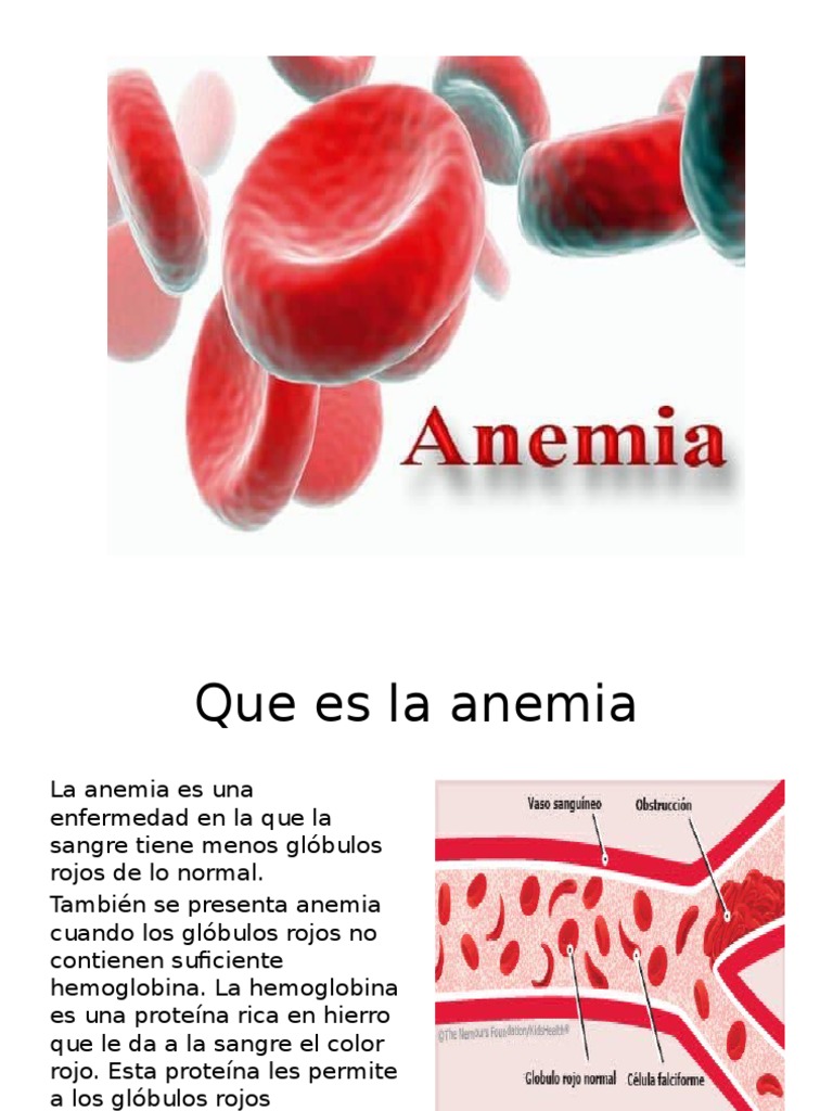Tipos y causas de la anemia | PDF | Anemia | Glóbulo rojo