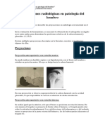 164158999-Protocolo-Proyecciones-Rx-de-Hombro.pdf