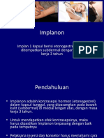03 Implanon-Profil Implan ENG
