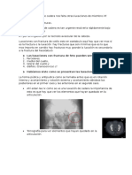 Pelvis Luxaciones de Cadera Nos Falta Otras Luxaciones de Miembro Inf Antes de Pasar a Farcturas