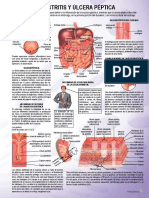 gastritis y ulcera.pdf