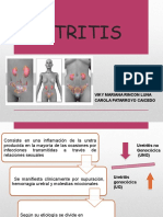 Uretritis: causas, síntomas y tratamiento