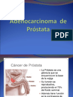 Adenocarcinoma de Próstata[1]