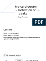 Electro-Cardiogram (ECG) - Detection of R-Peaks: Surya Penmetsa