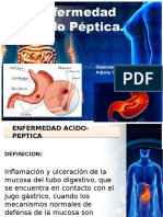 Enfermedad Acido Peptica