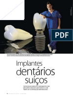 vb32-implantes dentaìrios