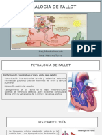 Tetralogía de Fallot: Malformación cardíaca congénita